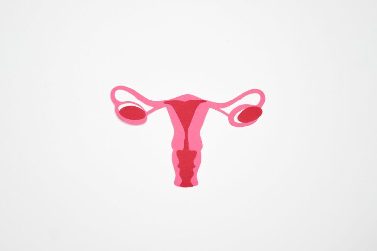 Endometrioza – dieta i suplementacja wspomagająca leczenie